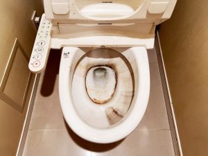 ひどいトイレの黒ずみ